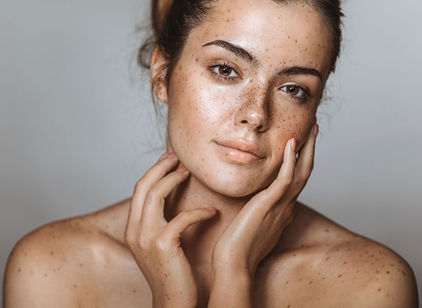 Anti wrinkle injections myths model 01