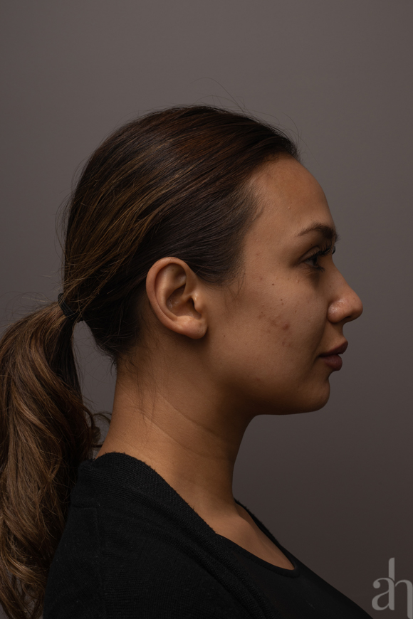 clinical photography - 2d clinical imaging - photo 01 - right side view